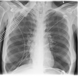 Case of the Week 2
