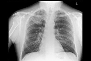 Case of the Week #4