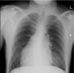 Week 3 Case of the Week
