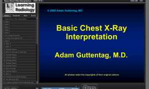 Basic CXR Interpretation Website
